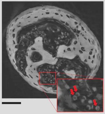 図2: 幼齢マウス耳小骨の位相CT（矢印は赤血球）。スケール：$50\mu\textrm{m}$。